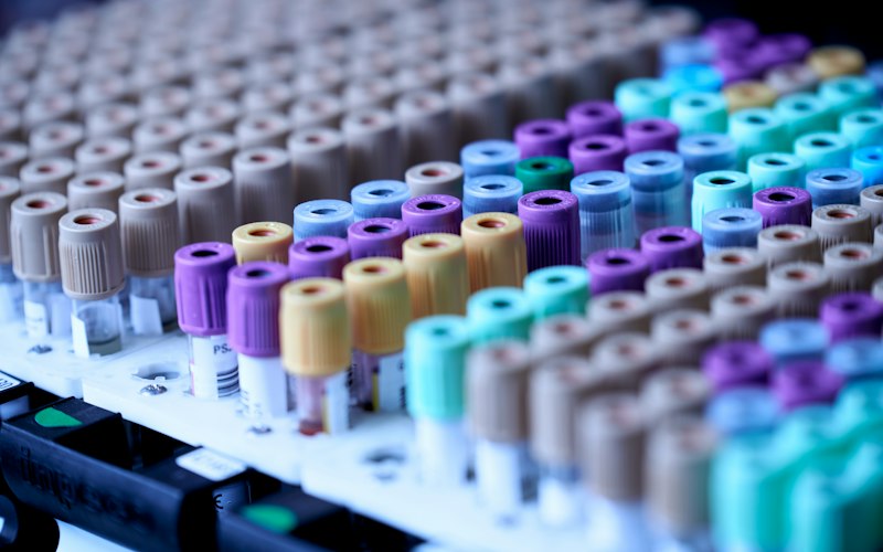Laboratory Information Systems (LIS)