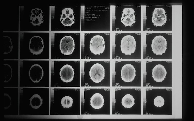 Medical Imaging AI